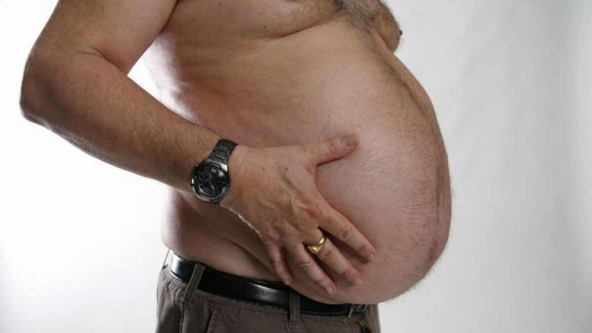ülekaalulisus kui veenilaiendite tekke põhjus