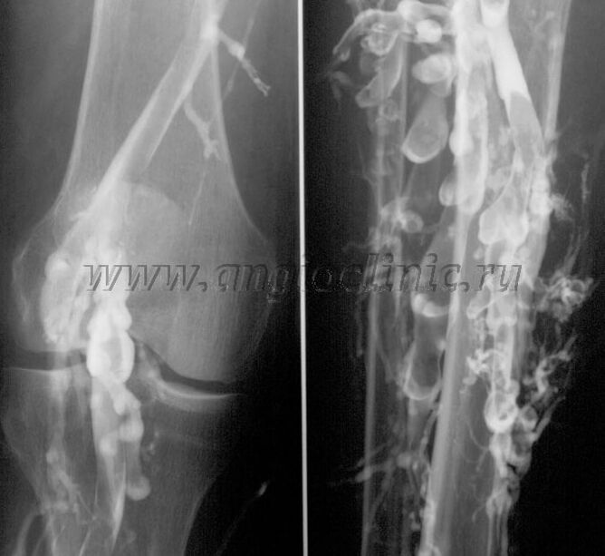 Ultraheli skaneerimine